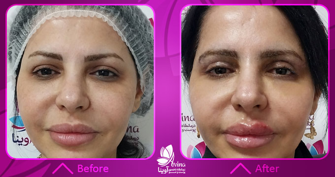 نمونه کار کروبسی تراپی در کلینیک اوینا