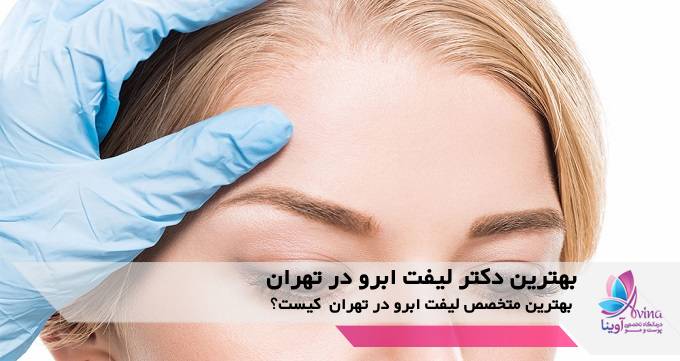بهترین دکتر لیفت ابرو در تهران