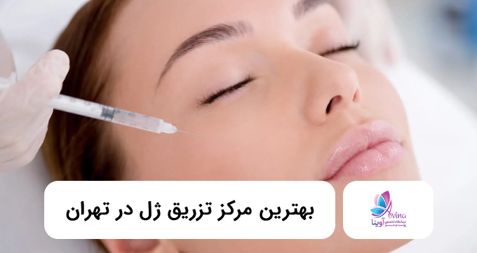 بهترین مرکز تزریق ژل در تهران