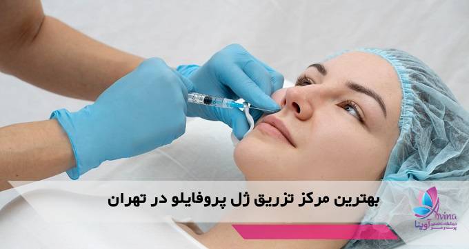 بهترین مرکز تزریق ژل پروفایلو در تهران