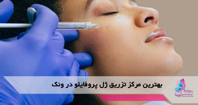 بهترین مرکز تزریق ژل پروفایلو در ونک