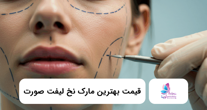قیمت بهترین مارک نخ لیفت صورت⭐【سال1405】✅