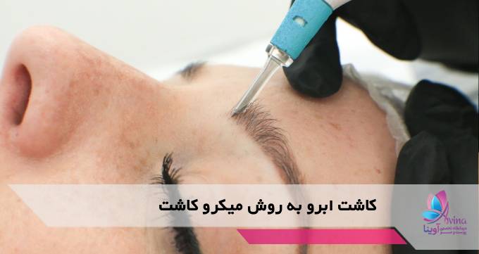 کاشت ابرو به روش میکرو کاشت