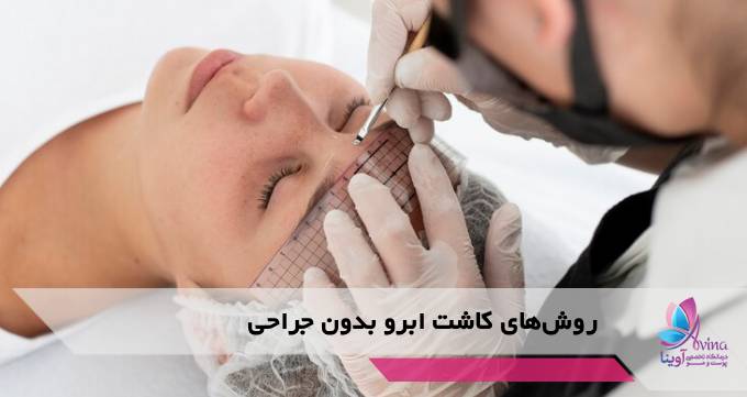 روشهای کاشت ابرو بدون جراحی