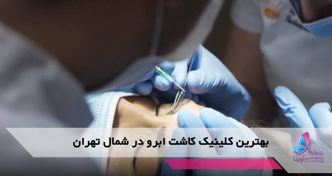 بهترین کلینیک کاشت ابرو در شمال تهران
