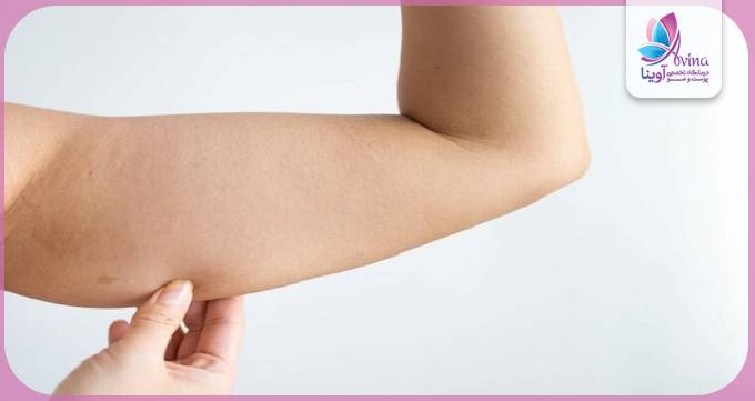 براکیوپلاستی برای چه کسانی مناسب است؟