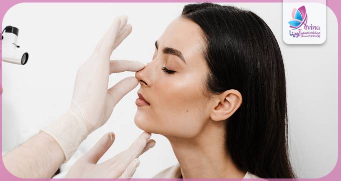 بهترین سن برای انجام رینوپلاستی در تهران