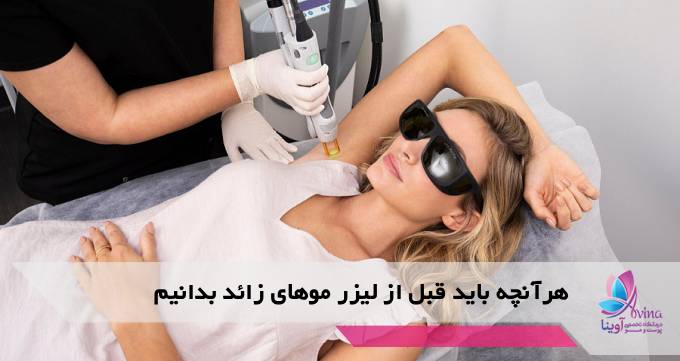 هرآنچه باید قبل از لیزر موهای زائد بدانیم
