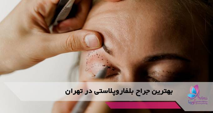 بهترین جراح بلفاروپلاستی در تهران