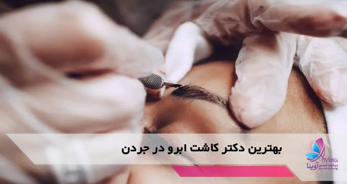 بهترین دکتر کاشت ابرو در جردن