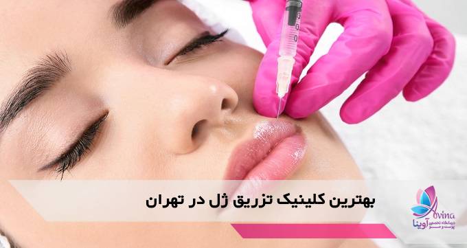 بهترین کلینیک تزریق ژل در تهران