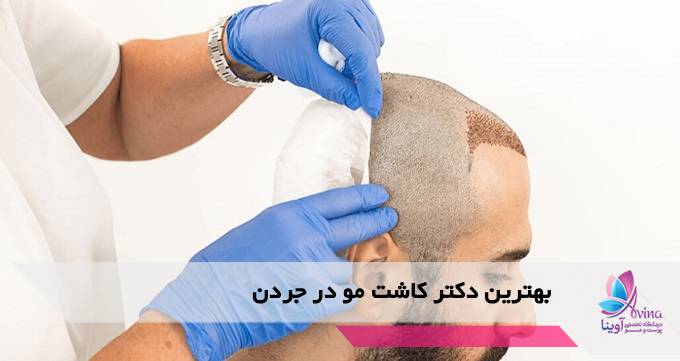 بهترین دکتر کاشت مو در جردن