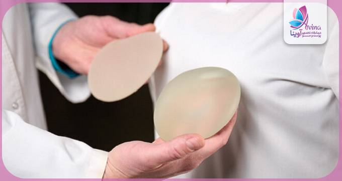 چه کسانی کاندیدای مناسب برای ماموپلاستی هستند؟