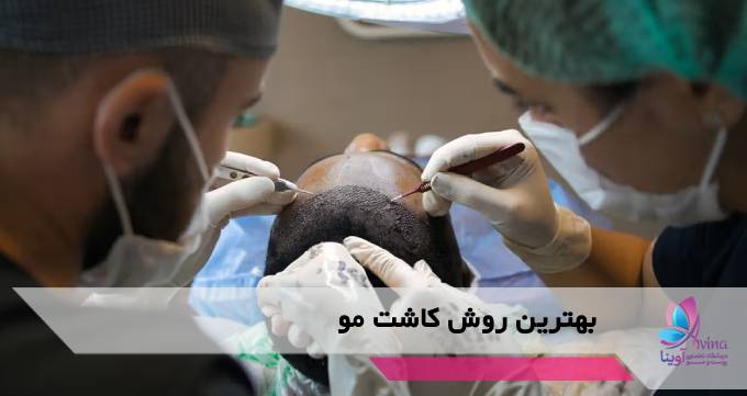 بهترین روش کاشت مو