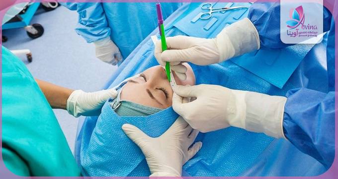 مراقبتهای بعد از جراحی زیبایی در تهران