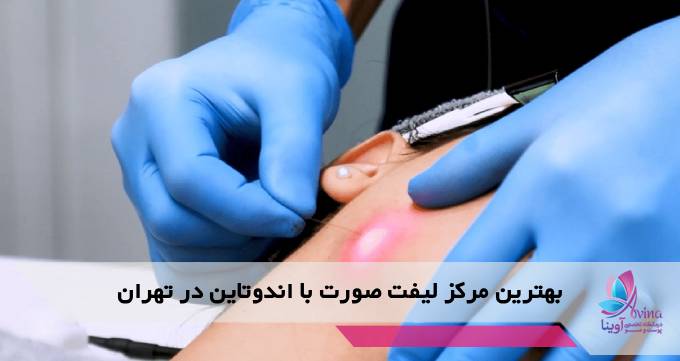 بهترین مرکز لیفت صورت با اندوتاین در تهران