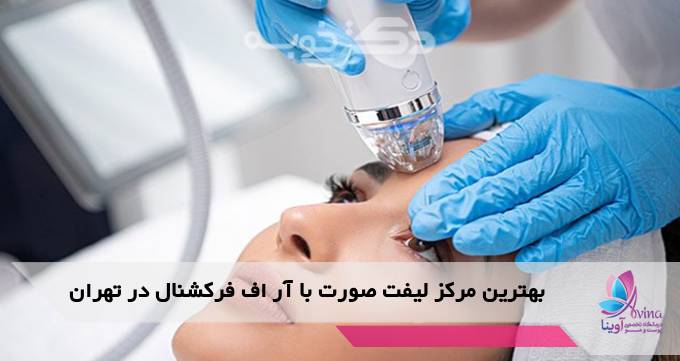 بهترین مرکز لیفت صورت با آر اف فرکشنال در تهران
