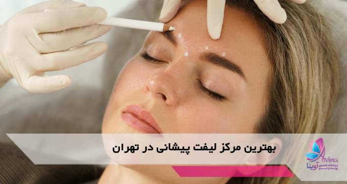 بهترین مرکز لیفت پیشانی در تهران