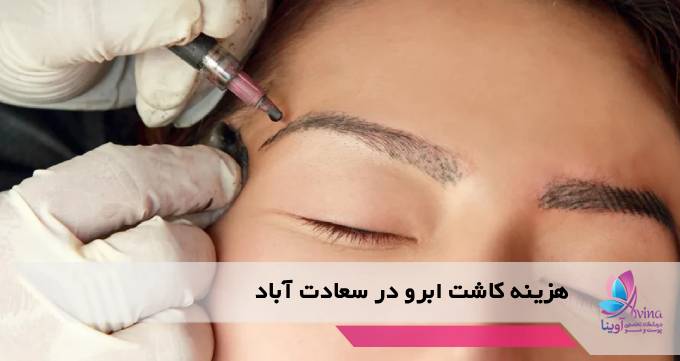 هزینه کاشت ابرو در سعادت آباد