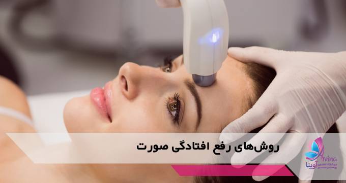 روشهای رفع افتادگی صورت