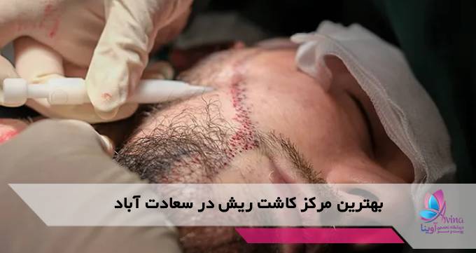 بهترین مرکز کاشت ریش در سعادت آباد