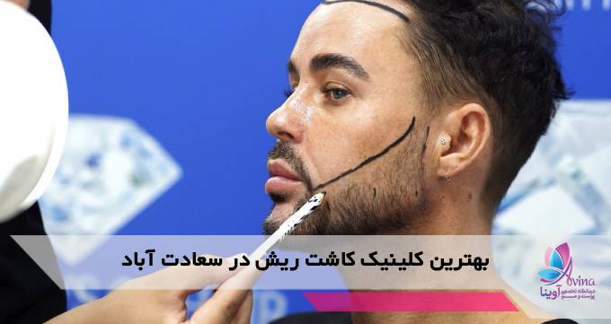 بهترین کلینیک کاشت ریش در سعادت آباد