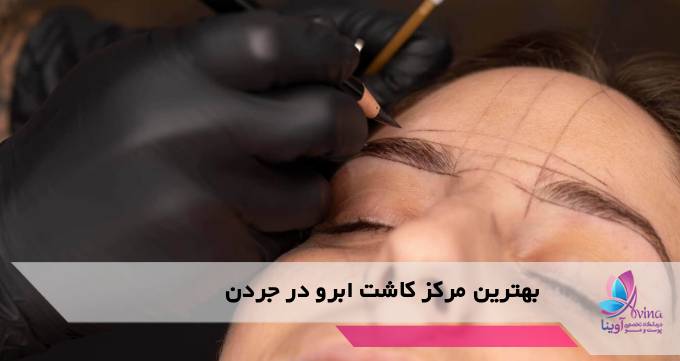 بهترین مرکز کاشت ابرو در جردن