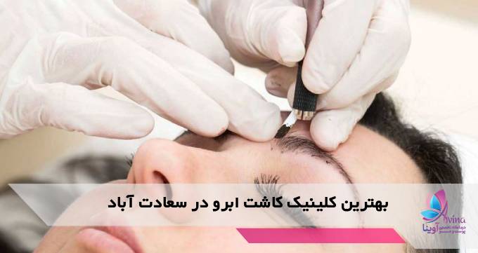 بهترین کلینیک کاشت ابرو در سعادت آباد