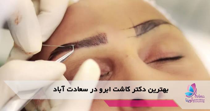بهترین دکتر کاشت ابرو در سعادت آباد