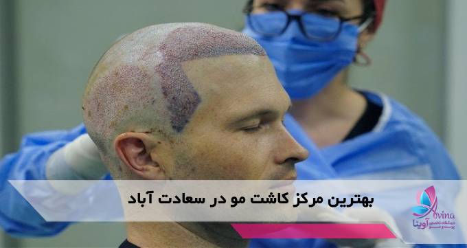 بهترین مرکز کاشت مو در سعادت آباد