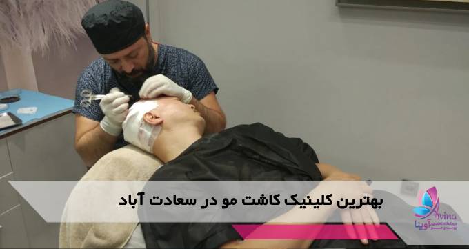 بهترین کلینیک کاشت مو در سعادت آباد