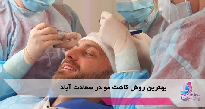 بهترین روش کاشت مو در سعادت آباد
