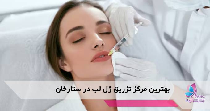 بهترین مرکز تزریق ژل لب در ستارخان