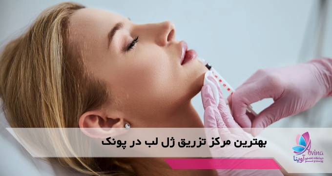 بهترین مرکز تزریق ژل لب در پونک