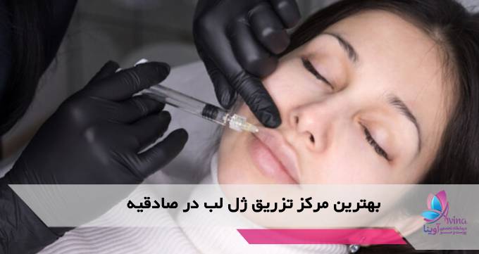 بهترین مرکز تزریق ژل لب در صادقیه