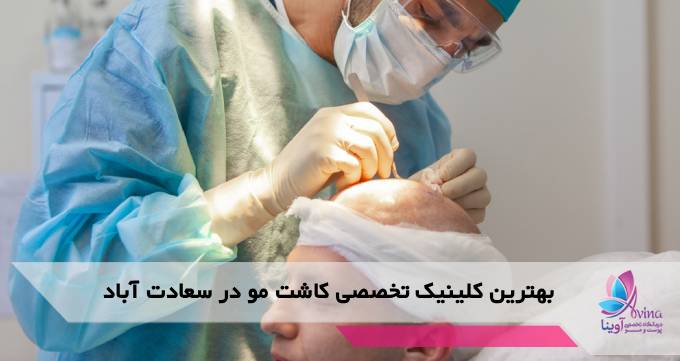 بهترین کلینیک تخصصی کاشت مو در سعادت آباد