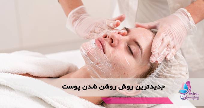 جدیدترین روش روشن شدن پوست