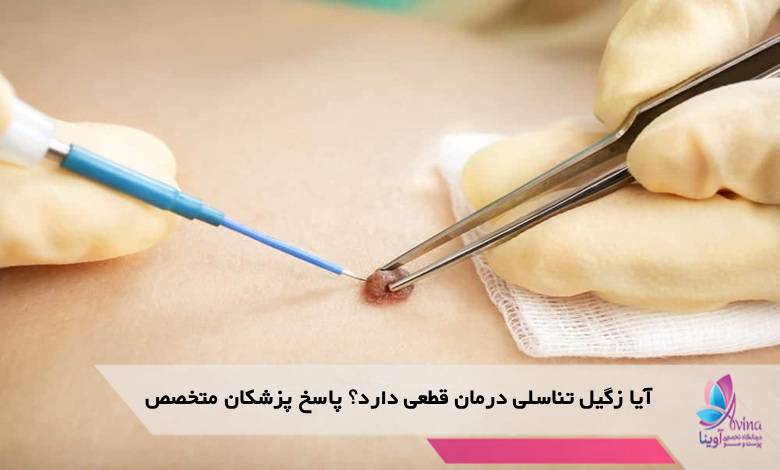 آیا زگیل تناسلی درمان قطعی دارد؟ پاسخ پزشکان متخصص