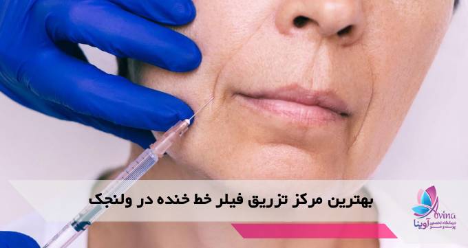 بهترین مرکز تزریق فیلر خط خنده در ولنجک