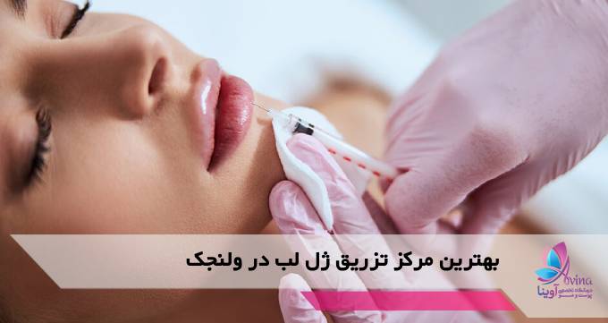 بهترین مرکز تزریق ژل لب در ولنجک