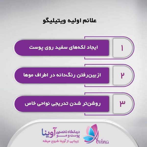 جدیدترین روش درمان ویتیلیگو