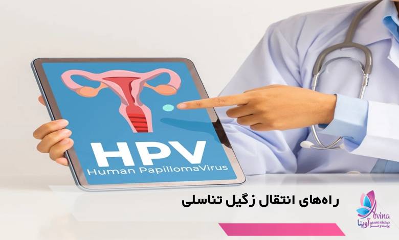 راههای انتقال زگیل تناسلی