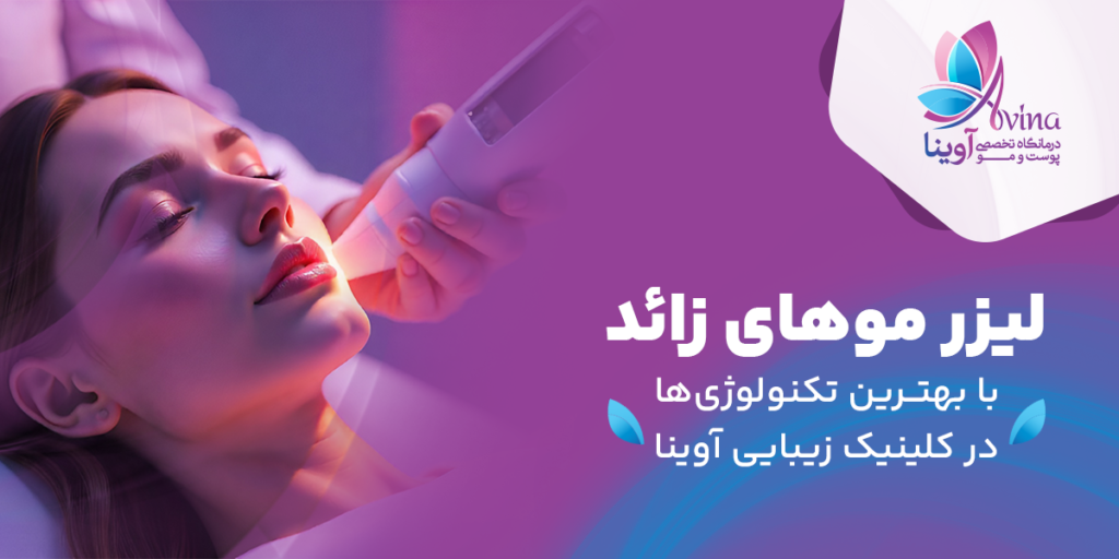 لیزر موهای زائد در کلینیک آوینا
