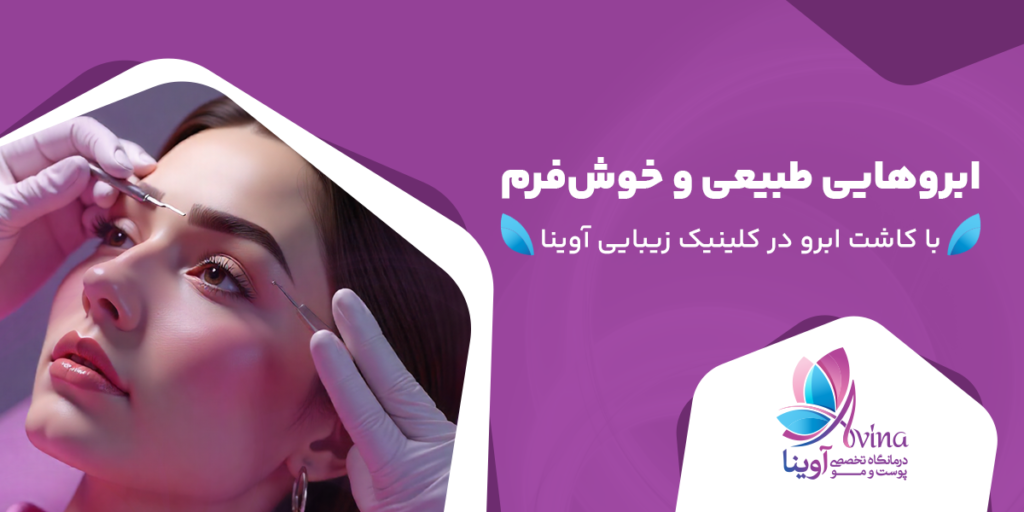 کاشت ابرو