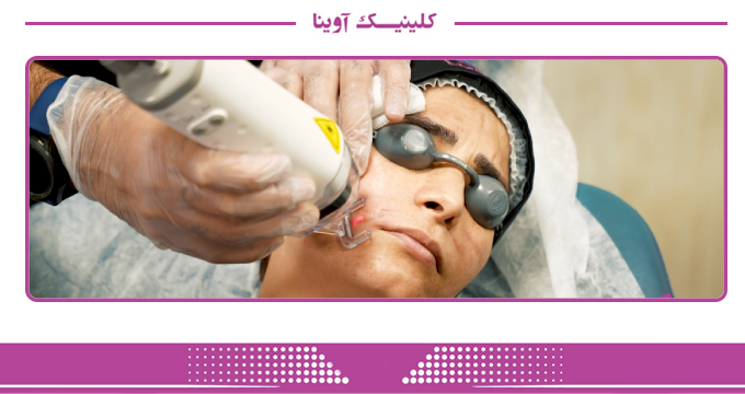جوانسازی و ترمیم پوست با لیزر فرکشنال
