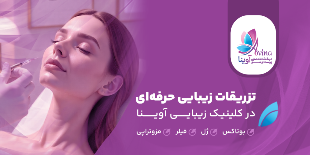 تزریق ژل لب