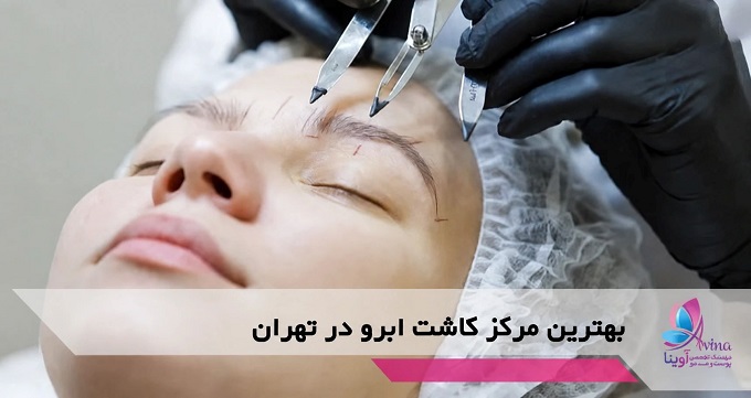 بهترین مرکز کاشت ابرو در تهران