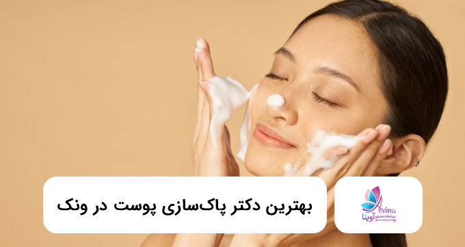 بهترین دکتر پاکسازی پوست در ونک